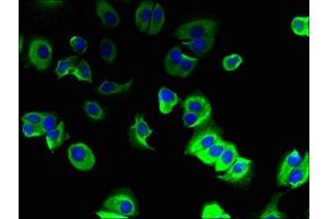 Immunofluorescent analysis of MCF-7 cells using ABIN7173293 at dilution of 1:100 and Alexa Fluor 488-congugated AffiniPure Goat Anti-Rabbit IgG(H+L) (TMEM91 antibody  (AA 1-97))