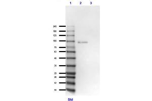 Western Blot of Goat Anti-GRK2 Antibody Western Blot of Goat Anti-GRK2 Antibody. (GRK2 antibody  (C-Term))