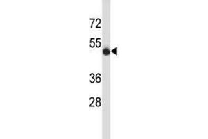 CD43 antibody western blot analysis in MDA-MB435 lysate. (CD43 antibody  (AA 32-60))