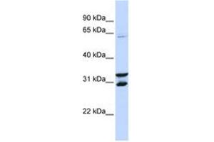 Image no. 1 for anti-F-Box Protein 24 (FBXO24) (AA 72-131) antibody (ABIN6743157) (FBXO24 antibody  (AA 72-131))