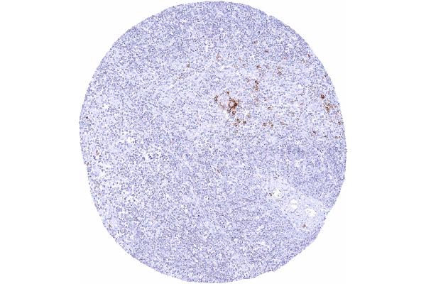 Recombinant IgD antibody