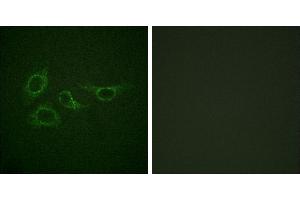 Peptide - +Immunofluorescence analysis of HepG2 cells, using Calmodulin (Ab-79/81) antibody. (Calmodulin 1 antibody  (Ser81, Thr79))