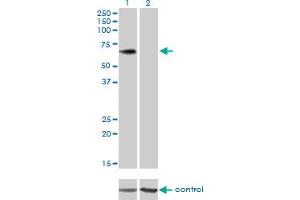 Western blot analysis of PLXDC1 over-expressed 293 cell line, cotransfected with PLXDC1 Validated Chimera RNAi (Lane 2) or non-transfected control (Lane 1). (PLXDC1 antibody  (AA 313-421))