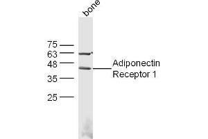 Mouse bone lysates probed with Adiponectin Receptor 1 Polyclonal Antibody, Unconjugated  at 1:300 dilution and 4˚C overnight incubation. (Adiponectin Receptor 1 antibody  (AA 241-270))