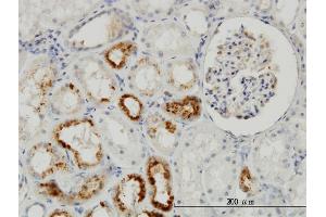 Immunoperoxidase of monoclonal antibody to TIMP2 on formalin-fixed paraffin-embedded human kidney.