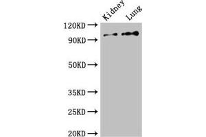 Western Blot Positive WB detected in: Mouse kidney tissue, Rat lung tissue All lanes: VAV3 antibody at 2.