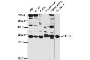 Western blot analysis of extracts of various cell lines, using TATDN1 antibody (ABIN6293775) at 1:3000 dilution. (TATDN1 antibody)