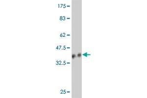 Western Blot detection against Immunogen (36. (NDUFB5 antibody  (AA 95-189))