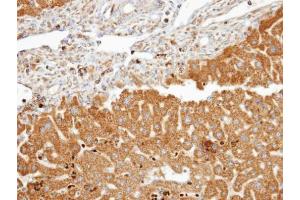 IHC-P Image Immunohistochemical analysis of paraffin-embedded human liver, using FDFT1, antibody at 1:100 dilution. (FDFT1 antibody)