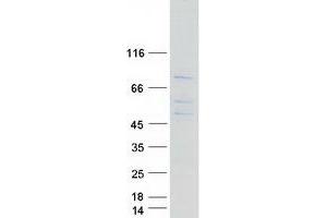 Validation with Western Blot