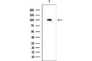 anti-ADAM Metallopeptidase Domain 23 (Adam23) (C-Term) antibody
