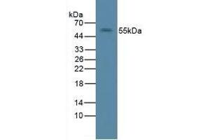 Detection of ErbB2 in Rat Liver Tissue using Polyclonal Antibody to Receptor Tyrosine Protein Kinase erbB-2 (ErbB2) (ErbB2/Her2 antibody  (AA 377-579))