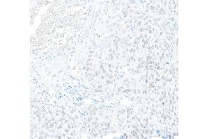 anti-Regulatory Factor X, 1 (Influences HLA Class II Expression) (RFX1) (AA 929-979) antibody