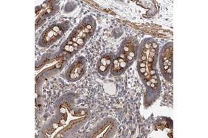 Immunohistochemical staining of human duodenum with SLC37A1 polyclonal antibody  shows strong granular positivity in glandular cells.
