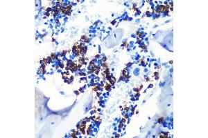 Immunohistochemistry of paraffin-embedded mouse bone marrow using S100 Rabbit mAb (ABIN7270128) at dilution of 1:100 (40x lens). (S100A8 antibody)