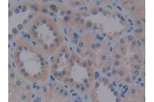 Detection of VLDLR in Human Kidney Tissue using Polyclonal Antibody to Very Low Density Lipoprotein Receptor (VLDLR) (VLDLR antibody  (AA 418-722))