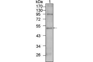 Western blot analysis using TBX5 mouse mAb against HepG2 cell lysate (1). (T-Box 5 antibody)