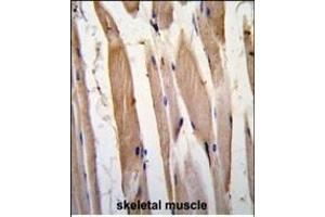 Formalin-fixed and paraffin-embedded human skeletal muscle tissue reacted with VINC antibody (N-term) , which was peroxidase-conjugated to the secondary antibody, followed by DAB staining. (Vinculin antibody  (N-Term))