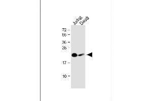All lanes : Anti-NCR3 Antibody (N-Term) at 1:1000 dilution Lane 1: Jurkat whole cell lysate Lane 2: Daudi whole cell lysate Lysates/proteins at 20 μg per lane. (NCR3 antibody  (AA 31-65))