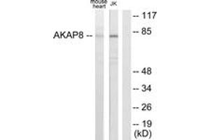 Western blot analysis of extracts from mouse heart/Jurkat cells, using AKAP8 Antibody. (AKAP8 antibody  (AA 331-380))
