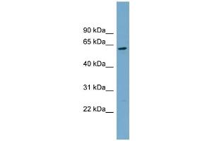 WB Suggested Anti-CNDP2 Antibody Titration: 0. (CNDP2 antibody  (Middle Region))