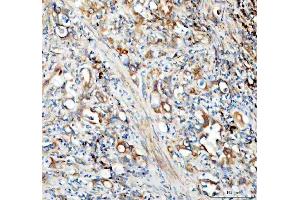 IHC analysis of SEC22B using anti-SEC22B antibody (ABIN7602121). (SEC22B antibody  (AA 6-197))
