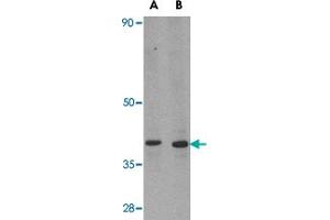 Western blot analysis of DHX58 in MDA-MB-361 cell lysate with DHX58 polyclonal antibody  at (A) 0. (DHX58 antibody  (N-Term))