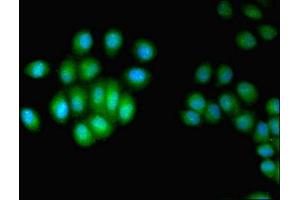 Immunofluorescent analysis of A549 cells using ABIN7147541 at dilution of 1:100 and Alexa Fluor 488-congugated AffiniPure Goat Anti-Rabbit IgG(H+L) (HUS1 antibody  (AA 2-280))