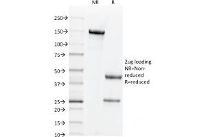 SDS-PAGE Analysis Purified CD44v6 Mouse Monoclonal Antibody (2F10). (CD44 antibody)