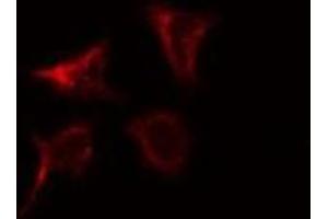 ABIN6276940 staining K562 by IF/ICC. (LIG3 antibody  (Internal Region))