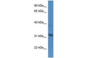 Image no. 1 for anti-SH3-Domain Binding Protein 5 (SH3BP5) (N-Term) antibody (ABIN6746815) (SH3BP5 antibody  (N-Term))