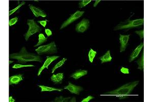 Immunofluorescence of monoclonal antibody to TUBA4A on HeLa cell.