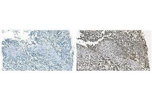 IHC analysis of GRSF1 using anti-GRSF1 antibody (ABIN7599803). (GRSF1 antibody  (AA 119-405))
