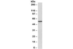 Western blot testing of human kidney lysate with Epoxide hydrolase 2 antibody at 0. (EPHX2 antibody)