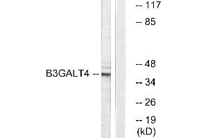 Western blot analysis of extracts from Jurkat cells, using B3GALT4 antibody.