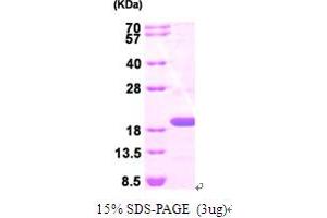 SDS-PAGE (SDS) image for Tumor Susceptibility Gene 101 (TSG101) (AA 1-145) protein (His tag) (ABIN667780) (TSG101 Protein (AA 1-145) (His tag))