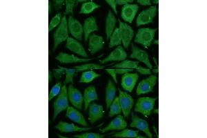 Immunofluorescence analysis of L929 cells using SARDH Polyclonal Antibody (ABIN6128753, ABIN6147379, ABIN6147380 and ABIN6225034) at dilution of 1:100 (40x lens). (SARDH antibody  (AA 300-560))