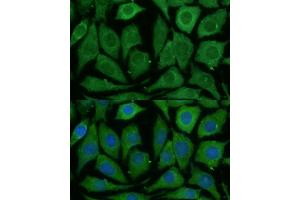 Immunofluorescence analysis of L929 cells using SARDH Polyclonal Antibody (ABIN6128753, ABIN6147379, ABIN6147380 and ABIN6225034) at dilution of 1:100 (40x lens).