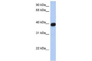 CXCR6 antibody (70R-10500) used at 0.