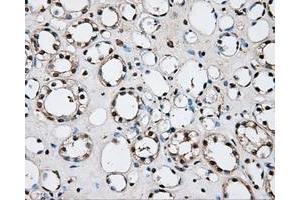 Immunohistochemical staining of paraffin-embedded liver tissue using anti-PLEKmouse monoclonal antibody. (Pleckstrin antibody)