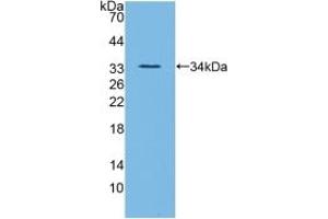 Detection of Recombinant ANGPTL3, Mouse using Polyclonal Antibody to Angiopoietin Like Protein 3 (ANGPTL3) (ANGPTL3 antibody  (AA 22-281))
