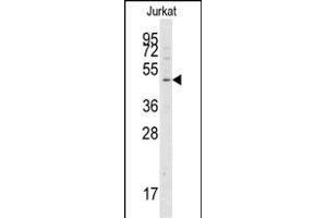 Western blot analysis of anti-G4A Pab 1808c in Jurkat cell line lysates (35 μg/lane). (ATG4A antibody  (AA 363-392))