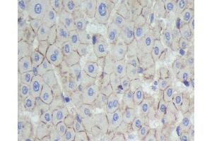 Immunohistochemistry analysis of paraffin-embedded human liver using N-cadherin Polyclonal Antibody at dilution of 1:500. (N-Cadherin antibody)