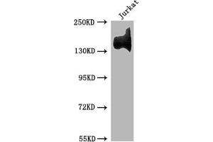 Western Blot Positive WB detected in: Jurkat whole cell lysate All lanes: ITGA4 antibody at 1:1500 Secondary Goat polyclonal to rabbit IgG at 1/50000 dilution Predicted band size: 115, 26 kDa Observed band size: 140 kDa (Recombinant ITGA4 antibody)