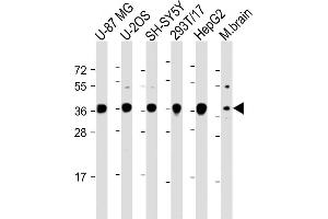 EN1 antibody  (N-Term)