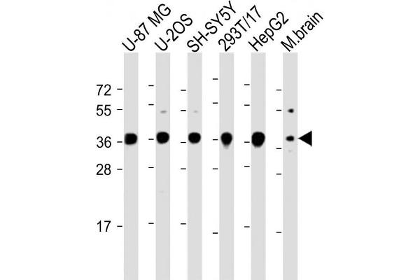 EN1 antibody  (N-Term)