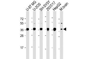 All lanes : Anti-EN1 (Engrailed 1) Antibody (N-term) at 1:2000 dilution Lane 1: U-87 MG whole cell lysate Lane 2: U-2OS whole cell lysate Lane 3: SH-SY5Y whole cell lysate Lane 4: 293T/17 whole cell lysate Lane 5: HepG2 whole cell lysate Lane 6: Mouse brain lysate Lysates/proteins at 20 μg per lane. (EN1 antibody  (N-Term))