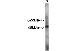 Western blot analysis using Sphingomyelin Synthase r  on recombinant protein Lane A] antibody alone. (SAMD8 antibody)