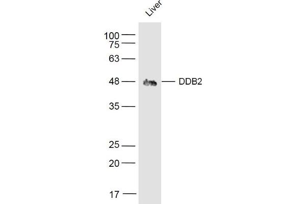 DDB2 antibody  (AA 201-300)