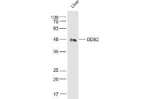 Mouse Liver lysates probed with DDB2 Polyclonal Antibody, Unconjugated  at 1:500 dilution and 4˚C overnight incubation. (DDB2 antibody  (AA 201-300))